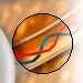 Optic Nerve